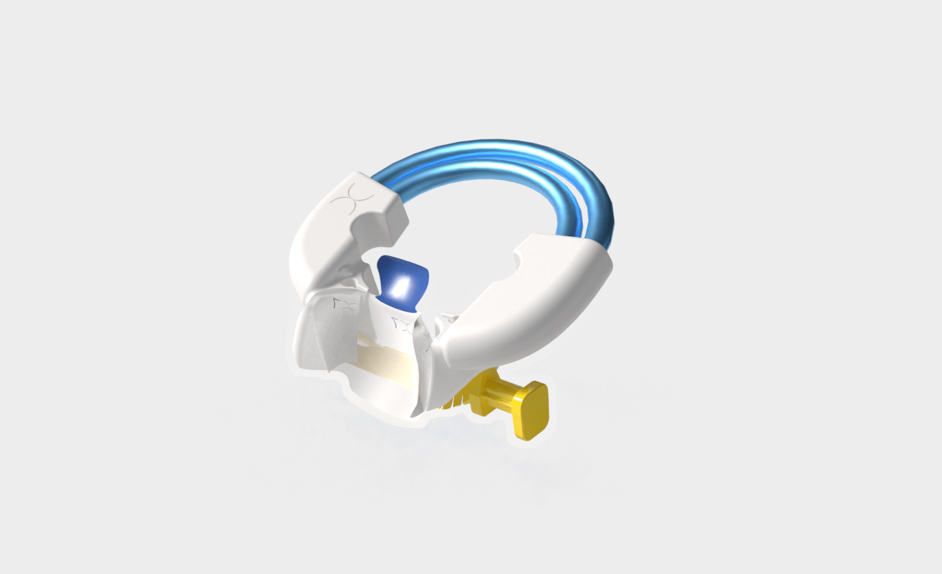Bioclear Complete Posterior Composite Course - www.bioclearmatrix.co.uk CORE - 24 DHTI
