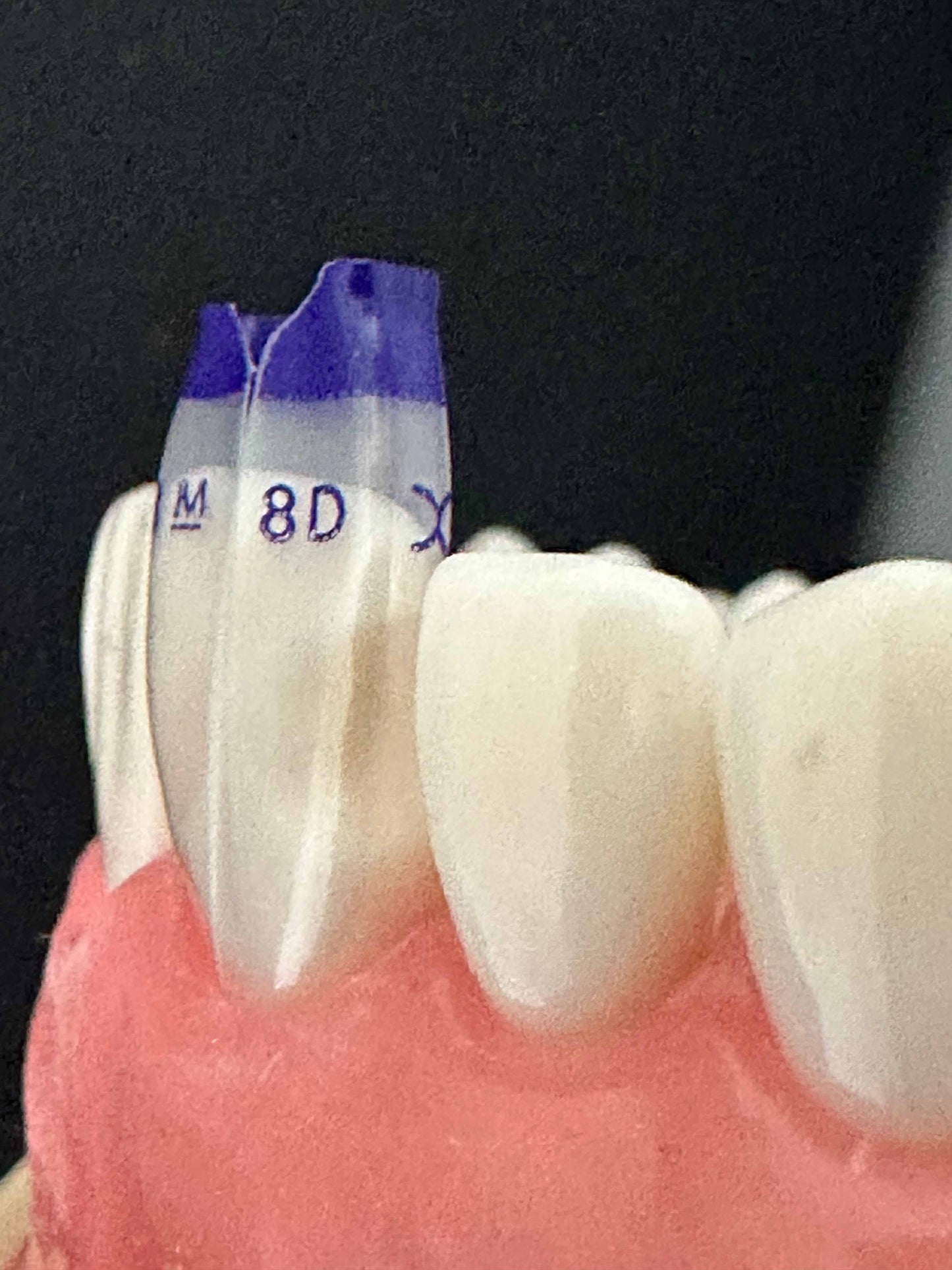 Bioclear TSS - Tooth & Surface Specific Kits