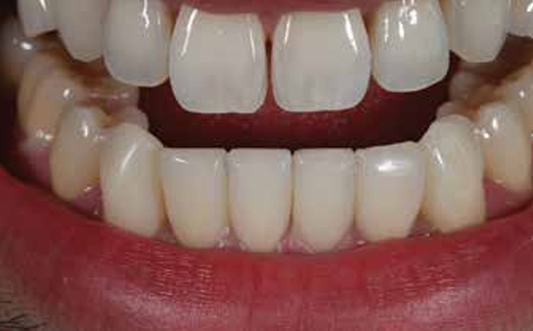 A New Technique for New Patients by Arthur R. Volker