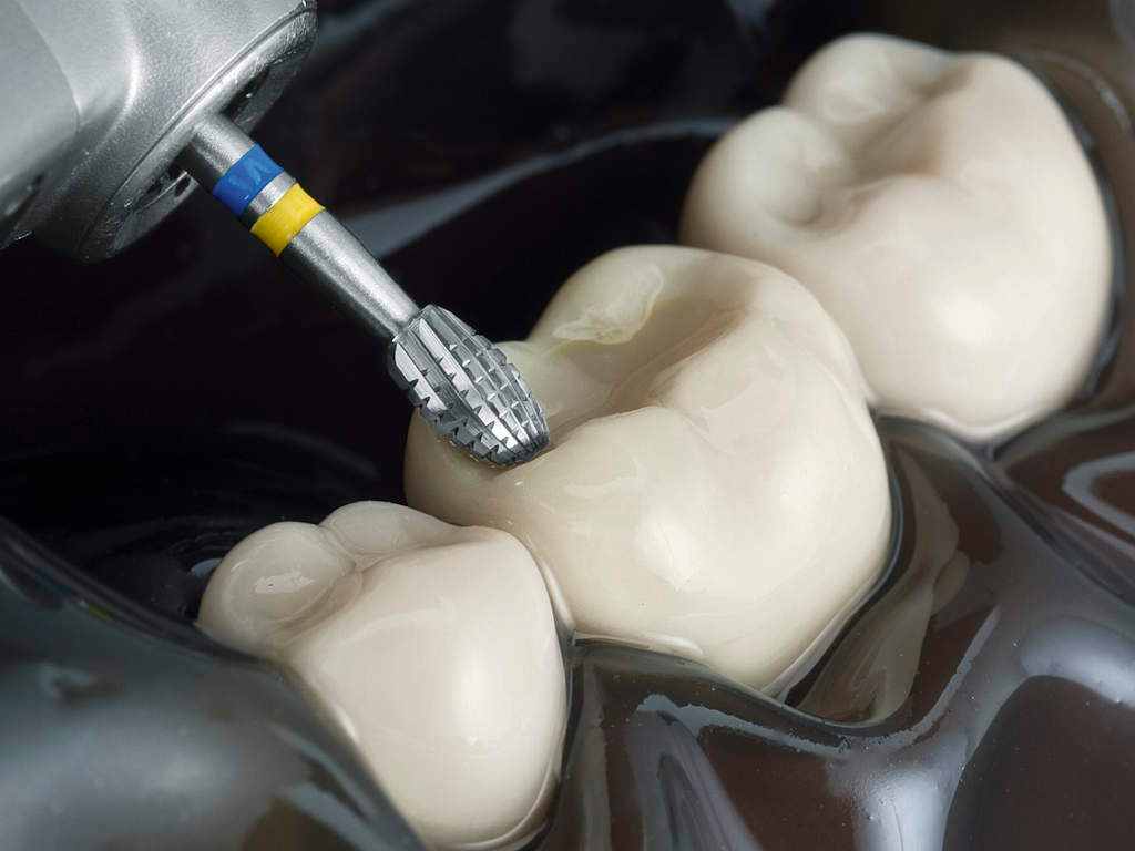 Komet Burs for Bioclear Dentistry – Bioclear UK