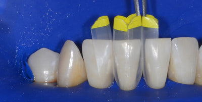 Bioclear Method – Bioclear Matrix UK