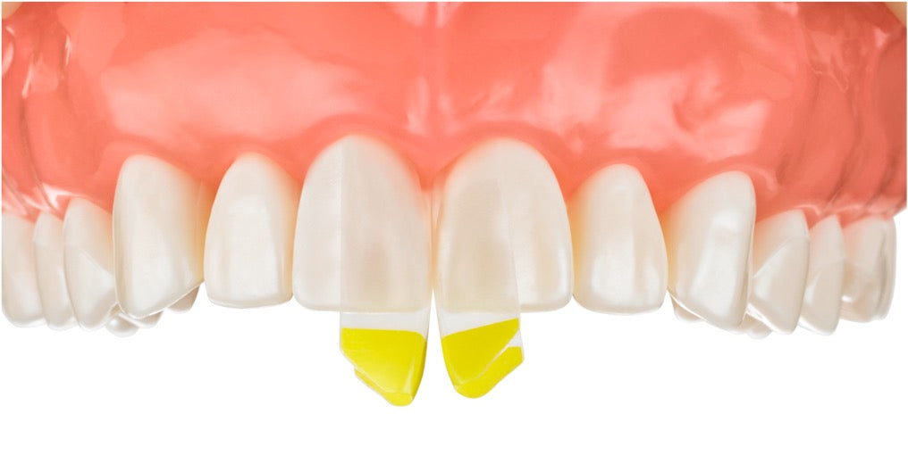 Bioclear Black Triangle Certification Course - Sat 11th October 2025