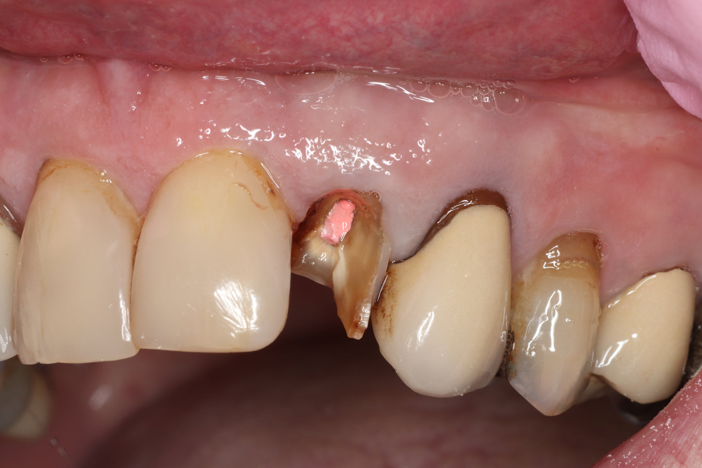 Bioclear 2-Day Complex Case Management Course - Fri Sat 12-13 March 2027