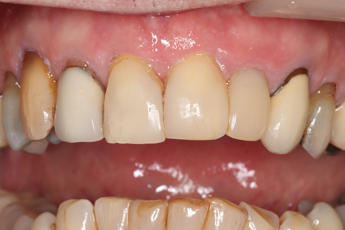 Bioclear 2-Day Complex Case Management Course - Fri Sat 12-13 March 2027