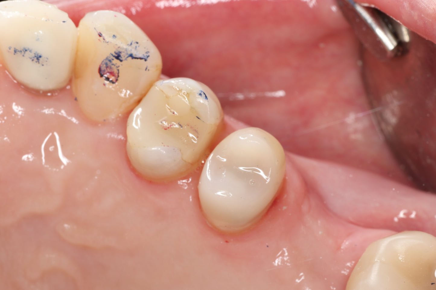 Bioclear 2-Day Complex Case Management Course - Fri Sat 12-13 March 2027