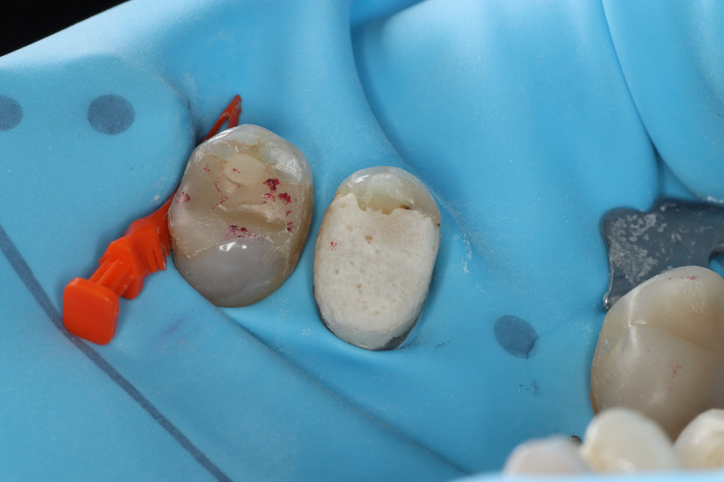 Bioclear 2-Day Complex Case Management Course - Fri Sat 12-13 March 2027