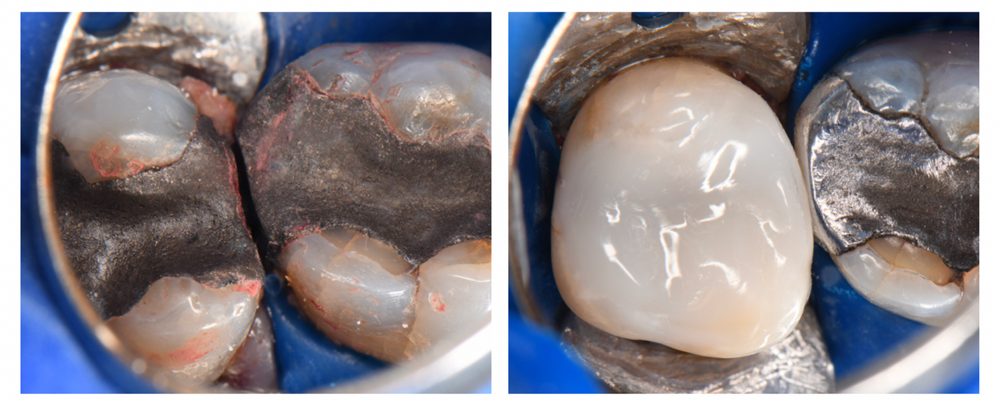 Bioclear 2-Day Complex Case Management Course - Fri Sat 12-13 March 2027