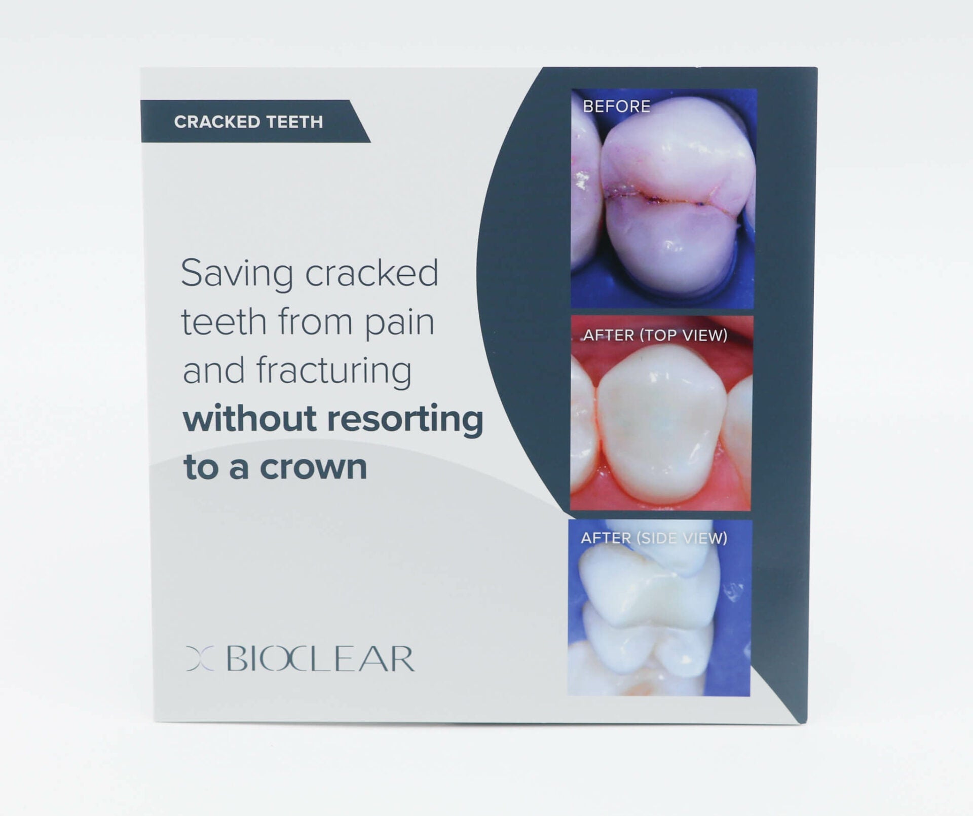 Patient Brochures - www.bioclearmatrix.co.uk 700371 Bioclear