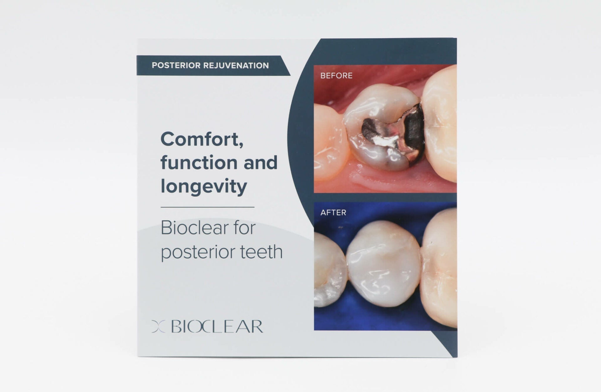 Patient Brochures - www.bioclearmatrix.co.uk 700361 Bioclear