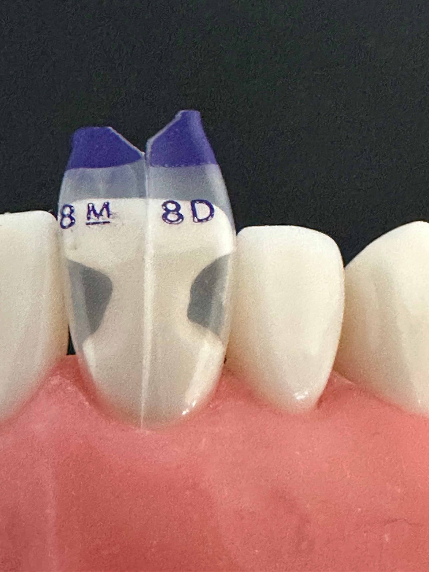 Bioclear TSS - Tooth & Surface Specific Kits