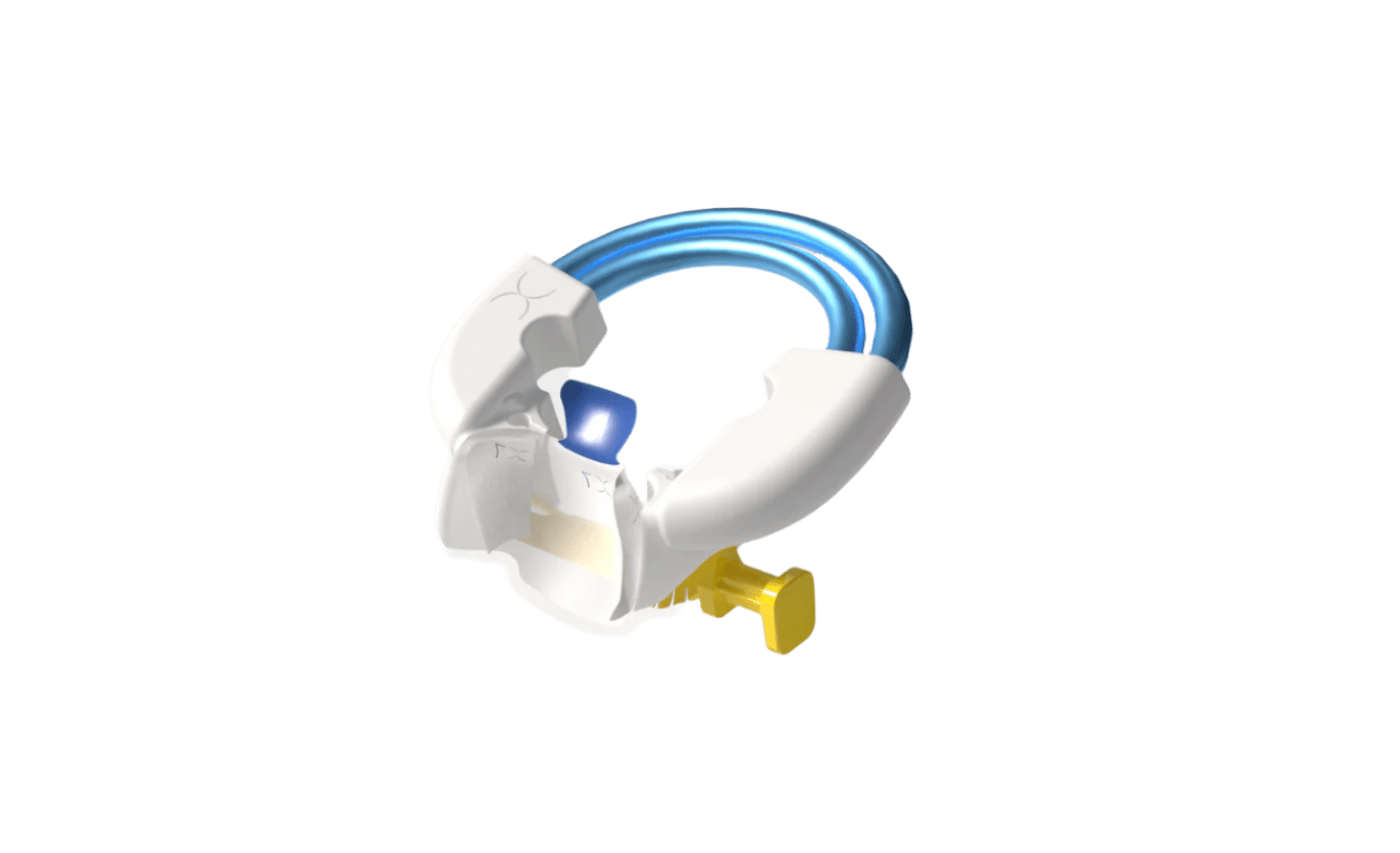 Twin Rings Universal 2PK - www.bioclearmatrix.co.uk 208042.2 Bioclear